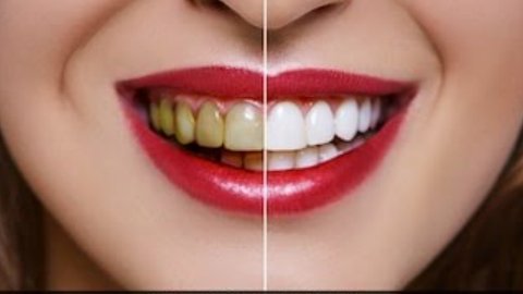 Teeth Whitening Home Remedy: मोतियों जैसे चमकने लगेंगे दांत, बस सोने से पहले करना है ये काम
